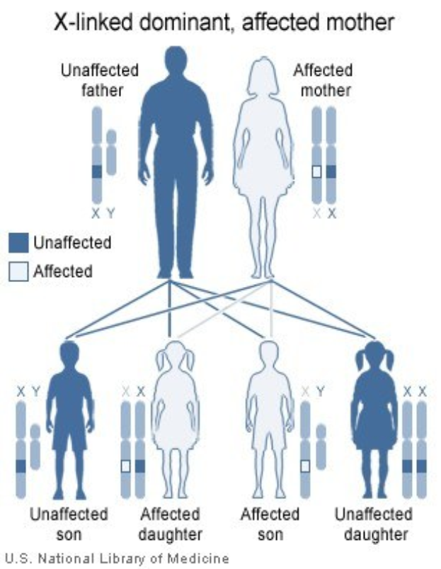 Diagramm eines X-verknüpften dominanten Familienstammbaums mit einer betroffenen Mutter und erklärendem Text.