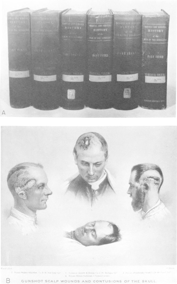 Ein Schwarz-Weiß-Foto eines Mannes mit einer Waffe, umgeben von Büchern, mit dem Text "Schussverletzungen am Schädel und Schädelkontusionen" unten.